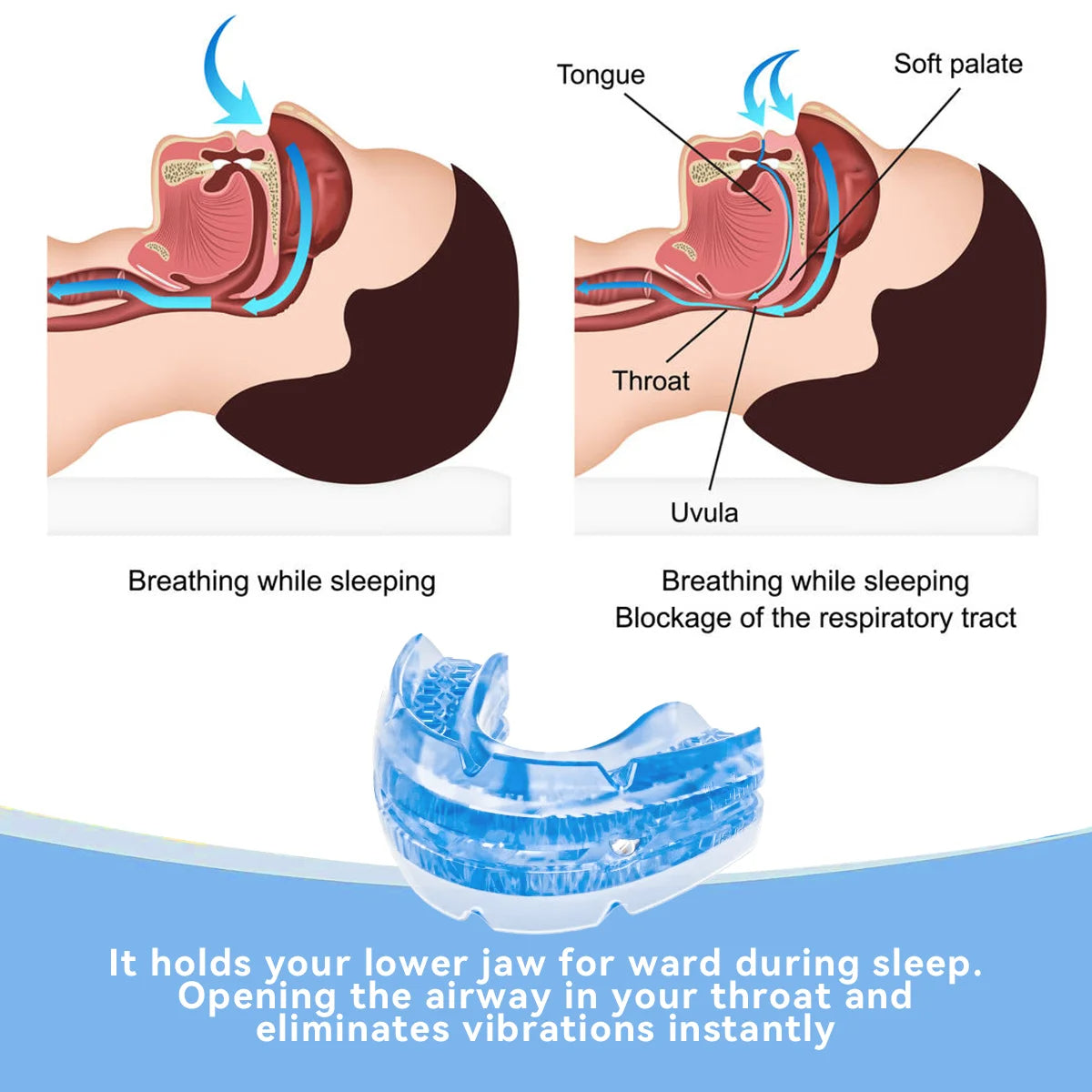 Glevato | Adjustable Anti-Snoring Mouthguard Made of BPA-Free Material