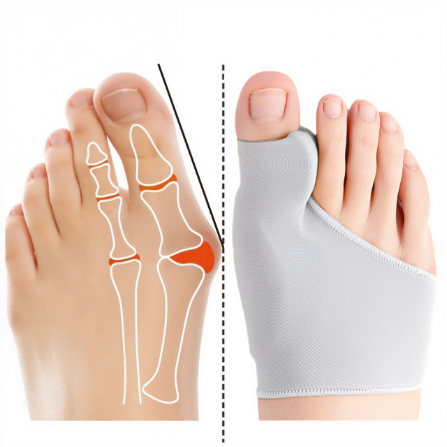 Glevato | Bunion Corrector Gel Pad Support