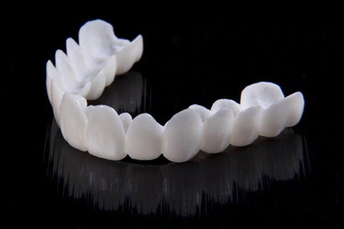 Glevato | DentAlign Dental Veneers – Natural Fit and Comfort
