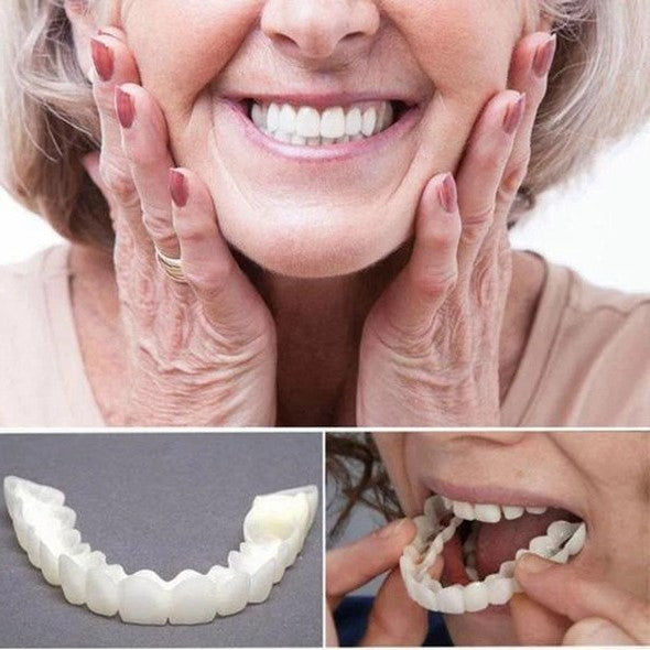 Glevato | On Smile Veneers (Upper and Lower Jaw included)